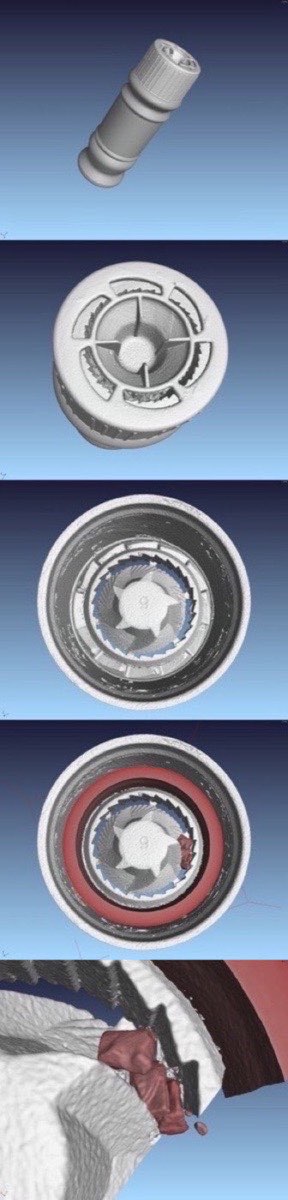 Компьютерная томография